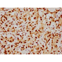 HDAC9 Antibody