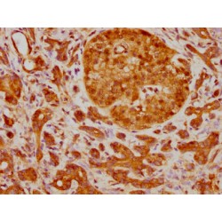 TP63 Antibody
