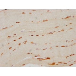 FTO Antibody