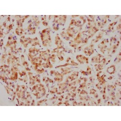 CDC5L Antibody