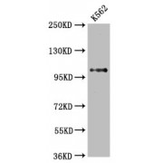 Western Blot<br/> Positive WB detected in: K562 whole cell lysate<br/> All lanes: DGCR8 antibody at 2.65 µg/ml<br/> Secondary<br/> Goat polyclonal to rabbit IgG at 1/50000 dilution<br/> Predicted band size: 87, 33, 83 KDa<br/> Observed band size: 100 KDa<br/>