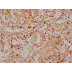 CA9 Antibody