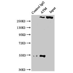 ATM Antibody