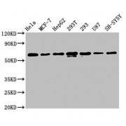 Western Blot<br/> Positive WB detected in: Hela whole cell lysate, MCF-7 whole cell lysate, HepG2 whole cell lysate, 293T whole cell lysate, 293 whole cell lysate, U87 whole cell lysate, SH-SY5Y whole cell lysate<br/> All lanes: HNRNPK antibody at 1.3 µg/ml<br/> Secondary<br/> Goat polyclonal to rabbit IgG at 1/50000 dilution<br/> Predicted band size: 51, 52, 49 KDa<br/> Observed band size: 60 KDa<br/>