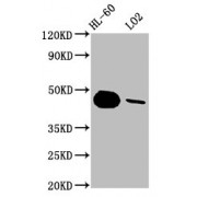 Western Blot<br/> Positive WB detected in: HL-60 whole cell lysate, LO2 whole cell lysate<br/> All lanes: CASP9 antibody at 1.8 µg/ml<br/> Secondary<br/> Goat polyclonal to rabbit IgG at 1/50000 dilution<br/> Predicted band size: 47, 31, 18, 37 KDa<br/> Observed band size: 47 KDa<br/>