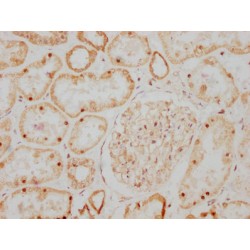 Glial Cell Line Derived Neurotrophic Factor (GDNF) Antibody
