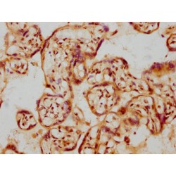 Glial Cell Line Derived Neurotrophic Factor (GDNF) Antibody