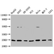 Western Blot<br/> Positive WB detected in: HepG2 whole cell lysate, 293T whole cell lysate, SH-SY5Y whole cell lysate, PC3 whole cell lysate, Hela whole cell lysate, MCF-7 whole cell lysate, U251 whole cell lysate<br/> All lanes: GDNF antibody at 1 µg/ml<br/> Secondary<br/> Goat polyclonal to rabbit IgG at 1/50000 dilution<br/> Predicted band size: 24, 21, 26, 23, 19 KDa<br/> Observed band size: 24 KDa<br/>