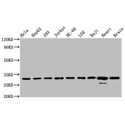 Western Blot<br/> Positive WB detected in: Hela whole cell lysate, HepG2 whole cell lysate, 293 whole cell lysate, Jurkat whole cell lysate, HL-60 whole cell lysate, LO2 whole cell lysate, Raji whole cell lysate, Rat heart tissue, Mouse brain tissue<br/> All lanes: VDAC1 antibody at 0.7 µg/ml<br/> Secondary<br/> Goat polyclonal to rabbit IgG at 1/50000 dilution<br/> Predicted band size: 31 KDa<br/> Observed band size: 31 KDa<br/>
