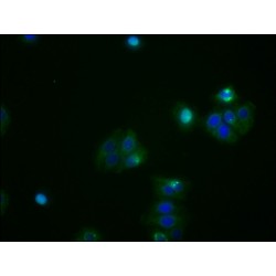 ATF4 Antibody