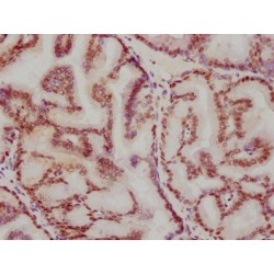 ATF2 Antibody