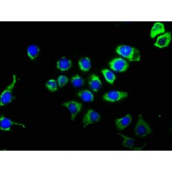CD63 Antigen (CD63) Antibody