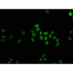 HNRNPC Antibody