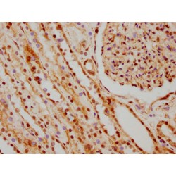 HNRNPC Antibody