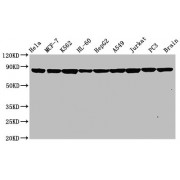 Western Blot<br/> Positive WB detected in: Hela whole cell lysate, MCF-7 whole cell lysate, K562 whole cell lysate, HL-60 whole cell lysate, HepG2 whole cell lysate, A549 whole cell lysate, Jurkat whole cell lysate, PC3 whole cell lysate, Rat brain tissue<br/> All lanes: Hsp90 alpha antibody at 0.8 µg/ml<br/> Secondary<br/> Goat polyclonal to rabbit IgG at 1/50000 dilution<br/> Predicted band size: 85, 99 KDa<br/> Observed band size: 85 KDa<br/>