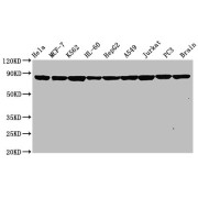 Western Blot<br/> Positive WB detected in: Hela whole cell lysate, MCF-7 whole cell lysate, K562 whole cell lysate, HL-60 whole cell lysate, HepG2 whole cell lysate, A549 whole cell lysate, Jurkat whole cell lysate, PC3 whole cell lysate, Rat brain tissue<br/> All lanes: Hsp90 alpha antibody at 0.8 µg/ml<br/> Secondary<br/> Goat polyclonal to rabbit IgG at 1/50000 dilution<br/> Predicted band size: 85, 99 KDa<br/> Observed band size: 85 KDa<br/>