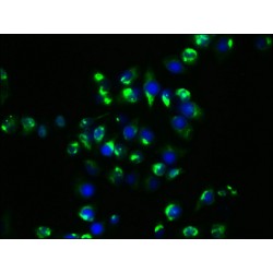 Heat Shock Protein HSP 90-Alpha (HSP90AA1) Antibody
