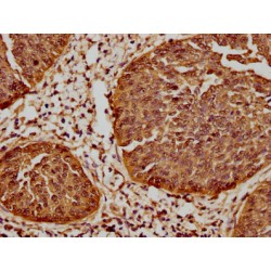 HSPB1 Antibody
