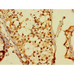 Double Homeobox Protein 4 (DUX4) Antibody