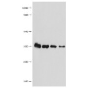 WB analysis of MALD1 recombinant protein, using MALD1 antibody (1/2000 dilution) and Goat anti-Rabbit IgG antibody (1/50000 dilution). Predicted band size: 34 kDa, Observed band size: 34 kDa.