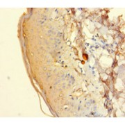 Immunohistochemistry of paraffin-embedded human adrenal gland tissue using HTR2A Antibody at dilution 1:100.