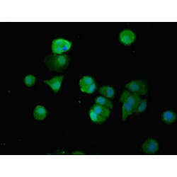 Telomerase-Binding Protein EST1A (SMG6) Antibody