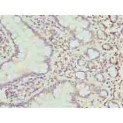 Cysteine Rich Secretory Protein LCCL Domain Containing 1 (CRISPLD1) Antibody