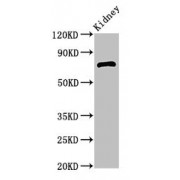 WB analysis of Mouse Kidney tissue, using ZBTB16 antibody (2.5 µg/ml). Predicted band size: 75, 62 kDa, observed band size: 75 kDa.