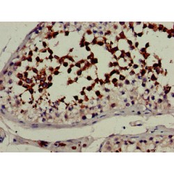 Lanosterol 14-Alpha Demethylase (CYP51A1) Antibody