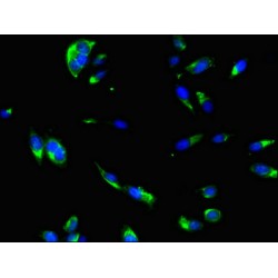 Putative Tyrosine-Protein Phosphatase Auxilin (DNAJC6) Antibody