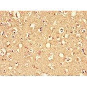 IHC-P analysis of Human Brain tissue, using DNAJC6 Antibody (1/100 dilution).