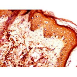 Putative Tyrosine-Protein Phosphatase Auxilin (DNAJC6) Antibody