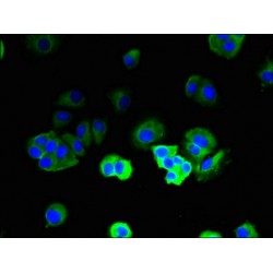 T Cell Receptor Beta Constant 1 (TRBC1) Antibody