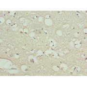 IHC-P analysis of human brain tissue, using KIAA0319L antibody (1/100 dilution).