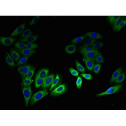 Leucine-Rich Single-Pass Membrane Protein 2 (LSMEM2) Antibody