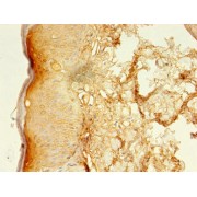 IHC-P analysis of human skin tissue, using LSMEM2 Antibody (1/100 dilution).