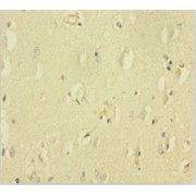 IHC-P analysis of human brain tissue, using GABRQ antibody (1/100 dilution).