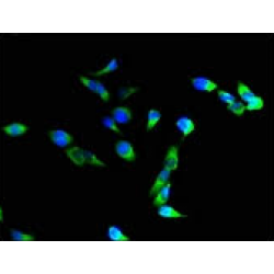 Integrin Alpha M / CD11b (ITGAM) Antibody