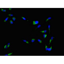 Myelin And Lymphocyte Protein (MAL) Antibody