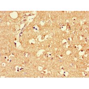 IHC-P analysis of paraffin embedded Human brain tissue using MLC1 antibody (1/100 dilution).