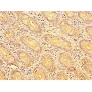 IHC-P analysis of human small intestine tissue, using SLC51A antibody (1/100 dilution).