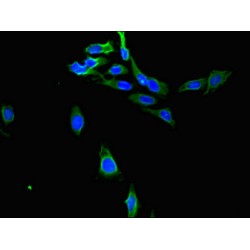 Prostaglandin Reductase 1 (PTGR1) Antibody