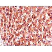 IHC-P analysis of human liver tissue, using PTGR1 Antibody (1/100 dilution).