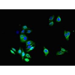 Aquaporin 1 (AQP1) Antibody
