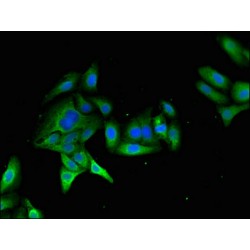 Myosin VIIA (MYO7A) Antibody