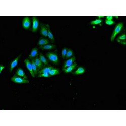 Sortilin Related VPS10 Domain Containing Receptor 2 (SORCS2) Antibody