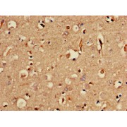 IHC-P analysis of human brain tissue, using SORCS2 antibody (1/100 dilution).