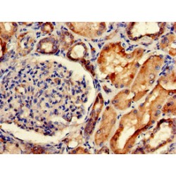 Sortilin Related VPS10 Domain Containing Receptor 2 (SORCS2) Antibody