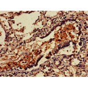 IHC-P analysis of human lung tissue, using VSIG4 antibody (1/100 dilution).