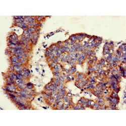 Beta-Galactosidase (GLB1) Antibody